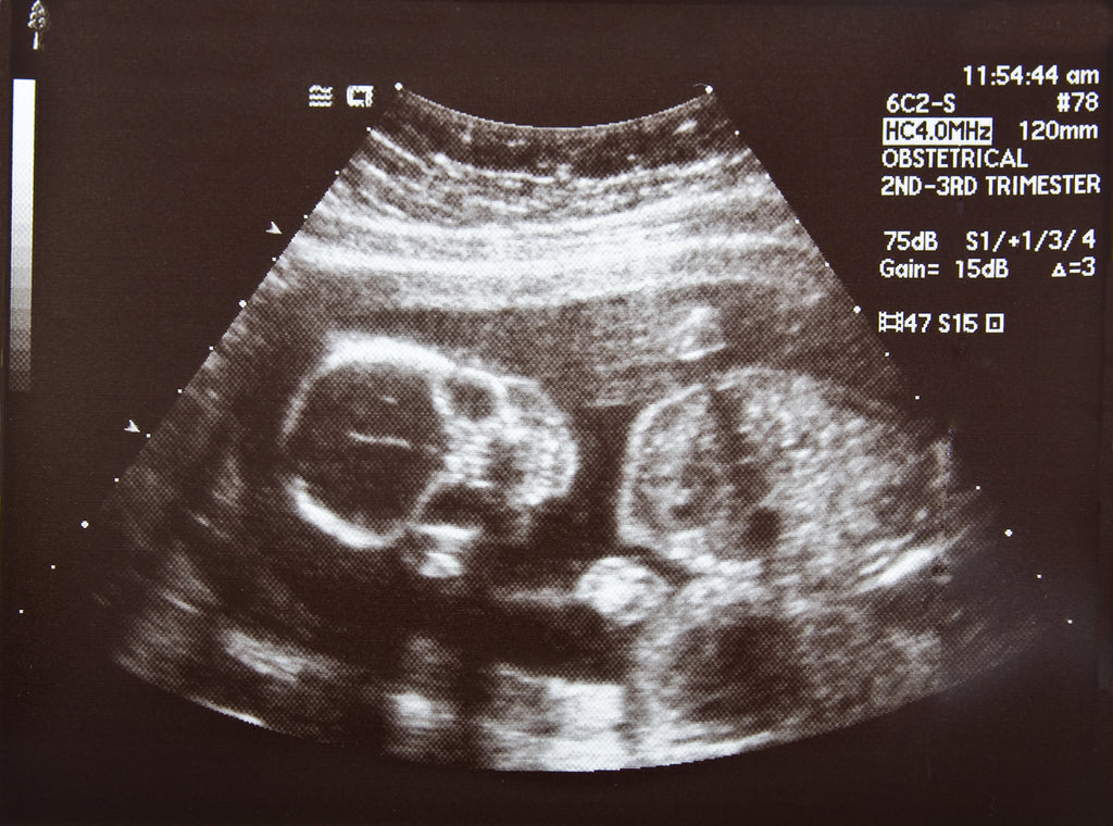 Your Growing Baby in the Second Trimester