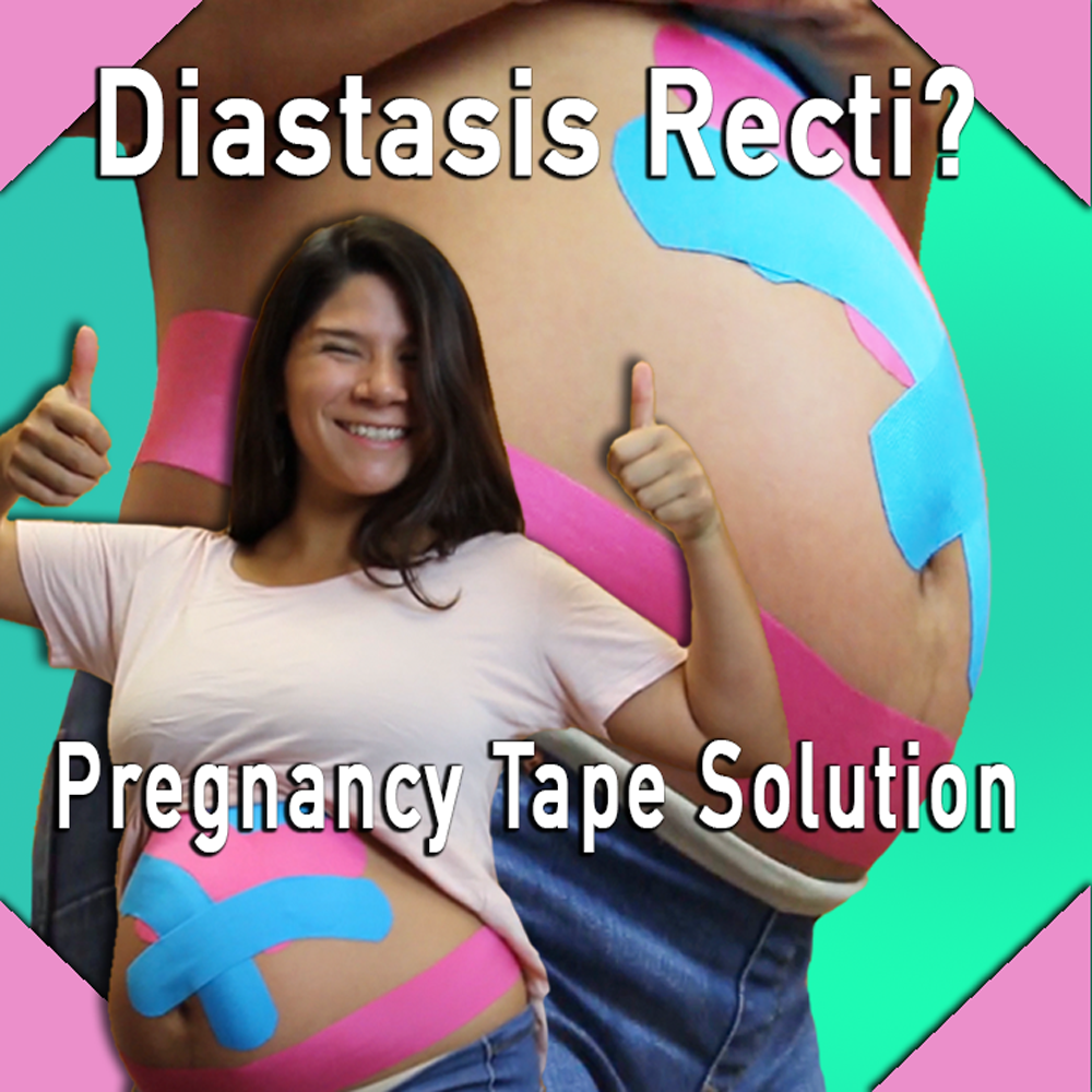 Pregnancy Taping for Diastasis Recti (Abdominal Seperation)